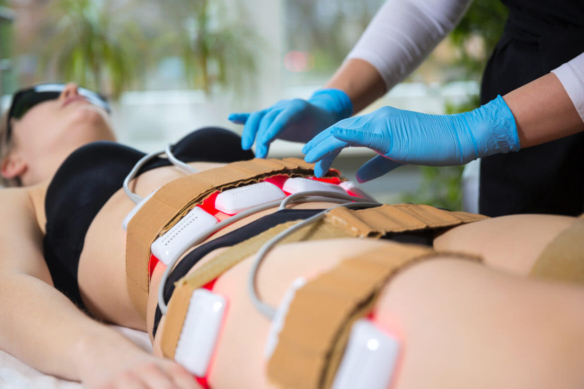 Are There Different Types of Laser Lipo?